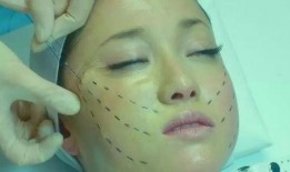 整形天后在线观看,揭秘美丽背后的秘密